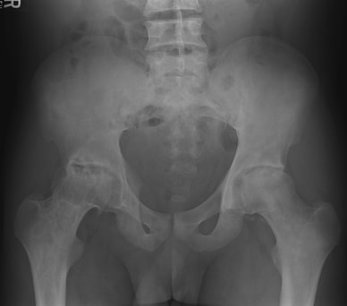 Joint X-ray Image